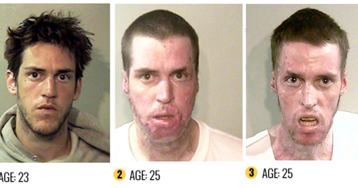 Meth Cause And Effect